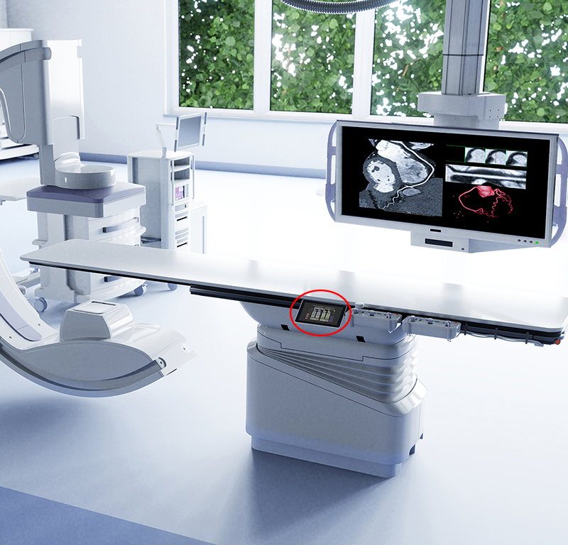 IBASE ODM Digital Angiography System