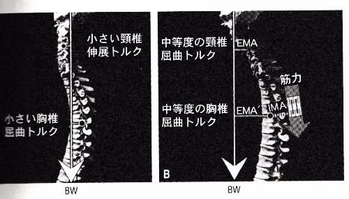 頭部前方偏位に伴う頸椎・筋肉への負荷増加