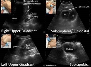 Ultrasound Tip of the Month