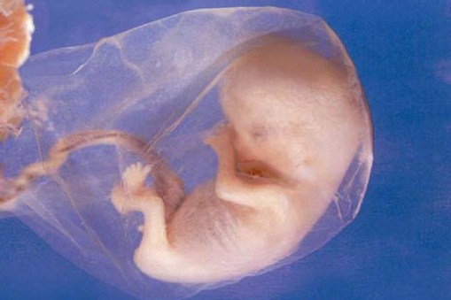 preborn child at 10 weeks after conception