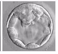 hollow ball of cells with a mass inside